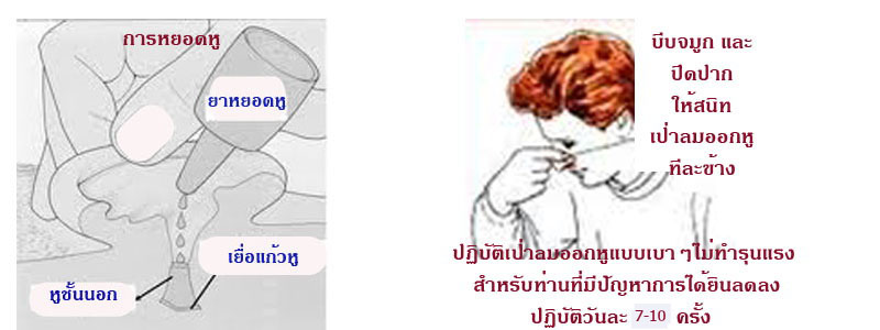 อาการหูอื้อ